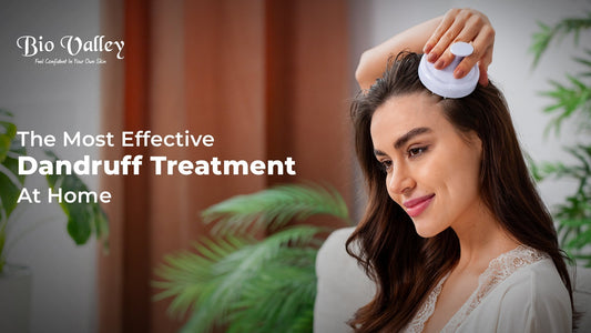 Effective Dandruff Treatment at Home